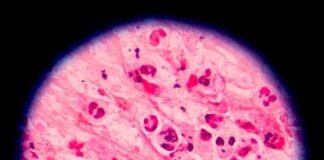 México confirma tres casos de Cyclospora y descarta un brote