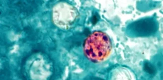 Mueren dos personas en Michigan por brote de ciclosporiasis